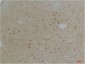 Kv1.1 potassium channel Polyclonal Antibody